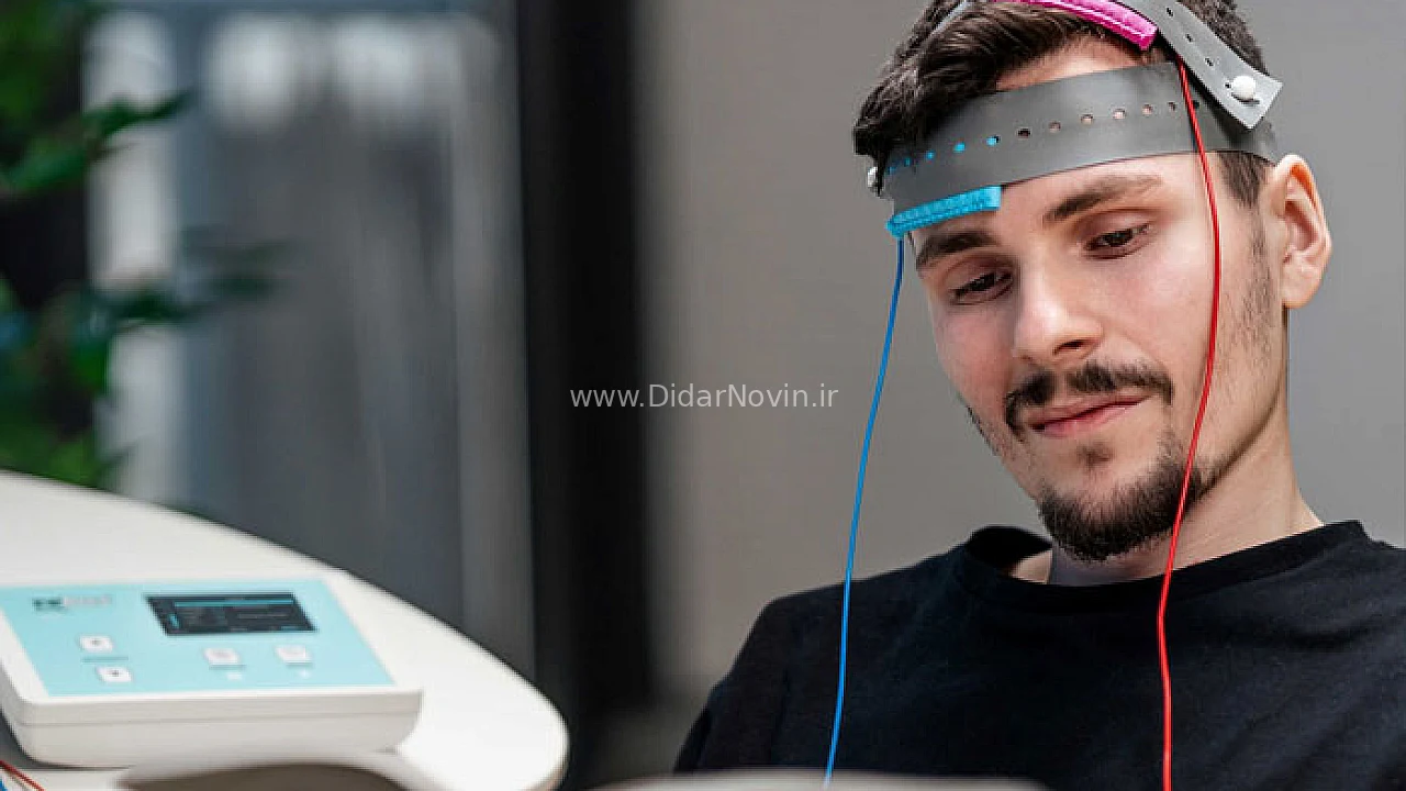 جهاز tDCS